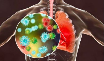Lung infection